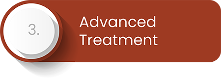 Advanced Treatment